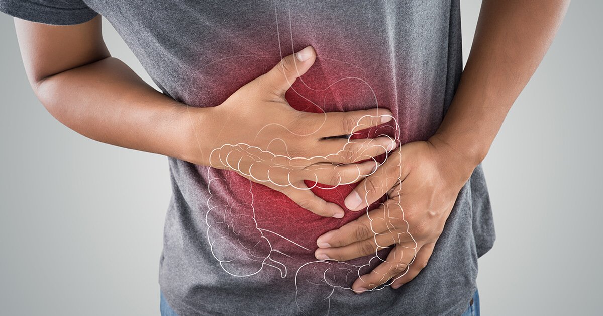 What is Crohn's Disease? - Birmingham Gastroenterology Associates