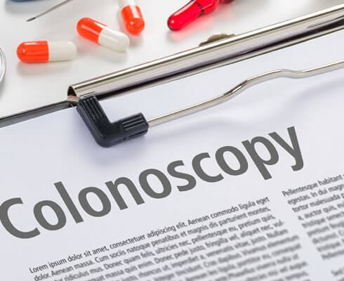The text Colonoscopy written on a clipboard; blog: Do You Know How Often You Should Get a Colonoscopy?