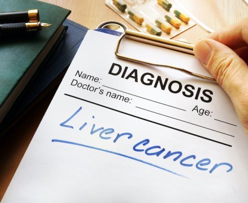 Liver cancer diagnosis on a medical form; blog: guide to liver cancer diagnosis