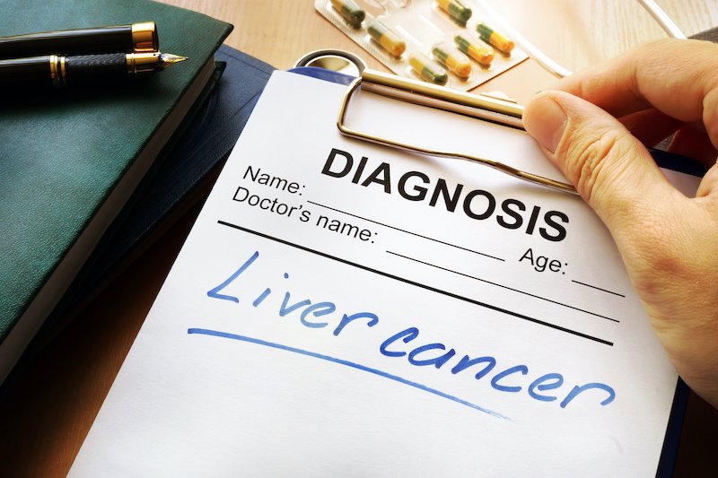 Liver cancer diagnosis on a medical form; blog: guide to liver cancer diagnosis