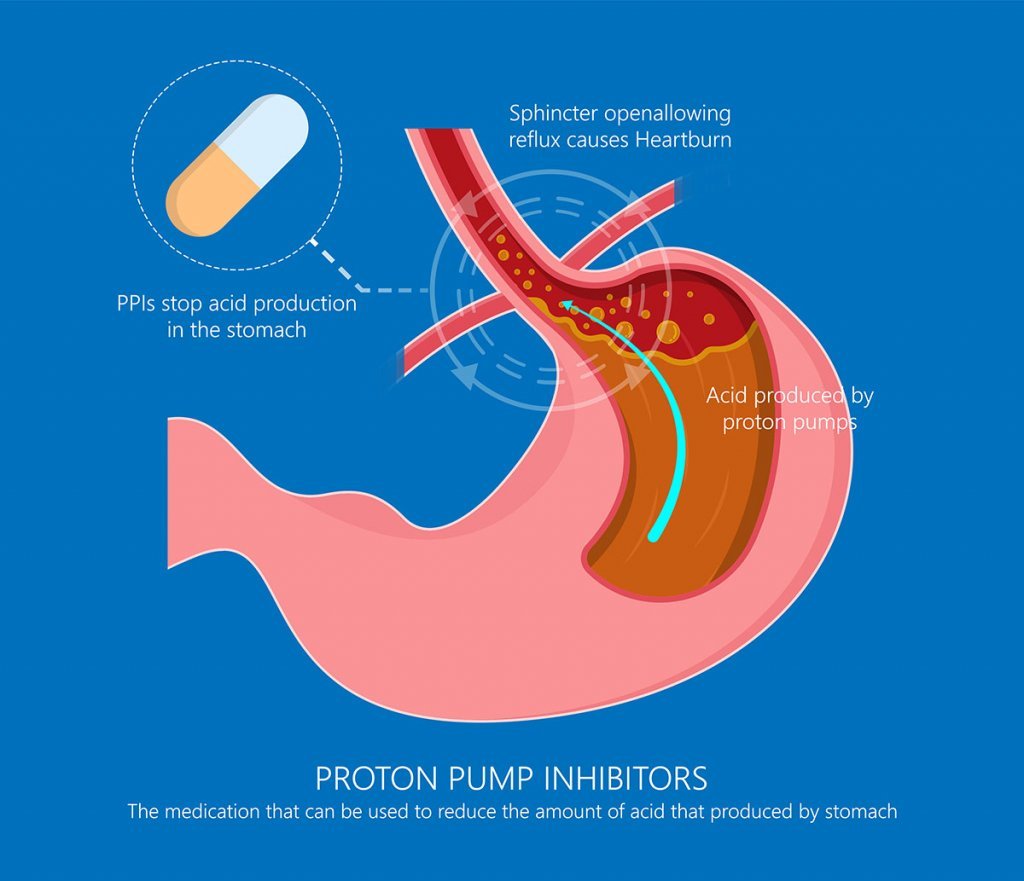 acid reflux medication