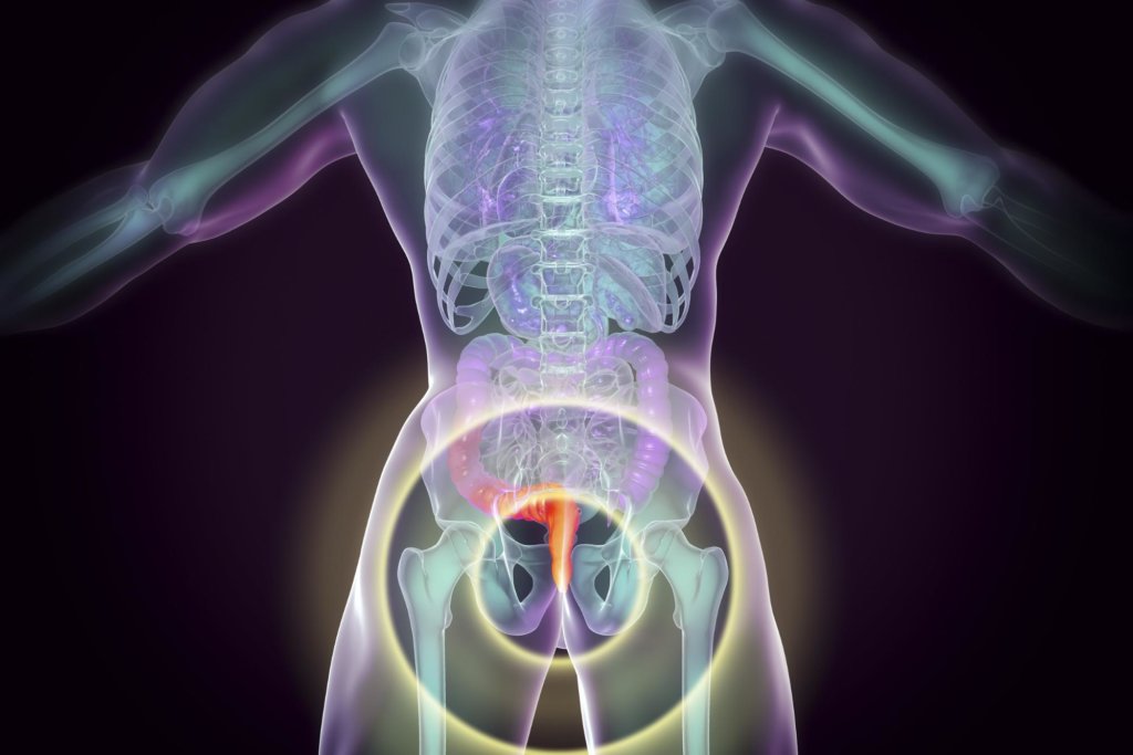 A diagram of where hemorrhoids occur