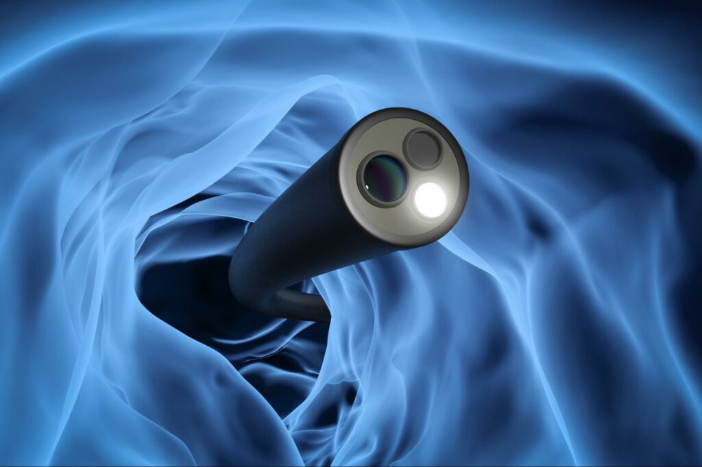 an animation of a tool used in a colonoscopy, one of the most Screenings Performed by Gastroenterologists